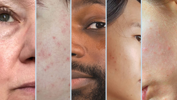 All Skin Types