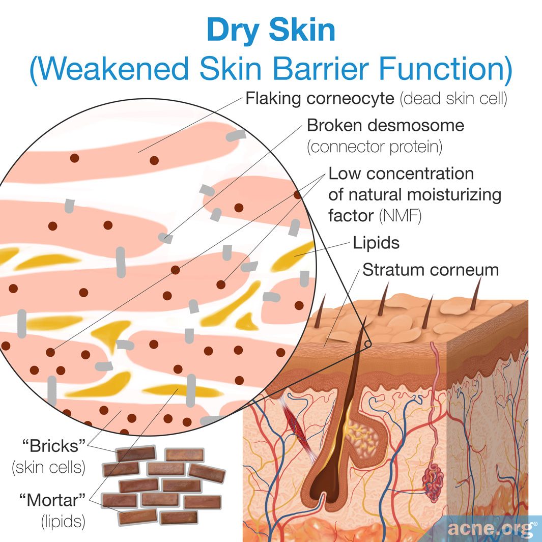 Dry Skin Products